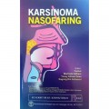 Karsinoma Nasofaring